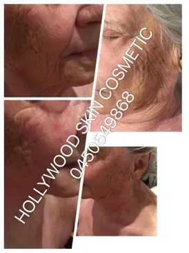A collage of client photographs of the face and neck